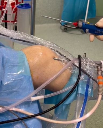 Operación de rodilla