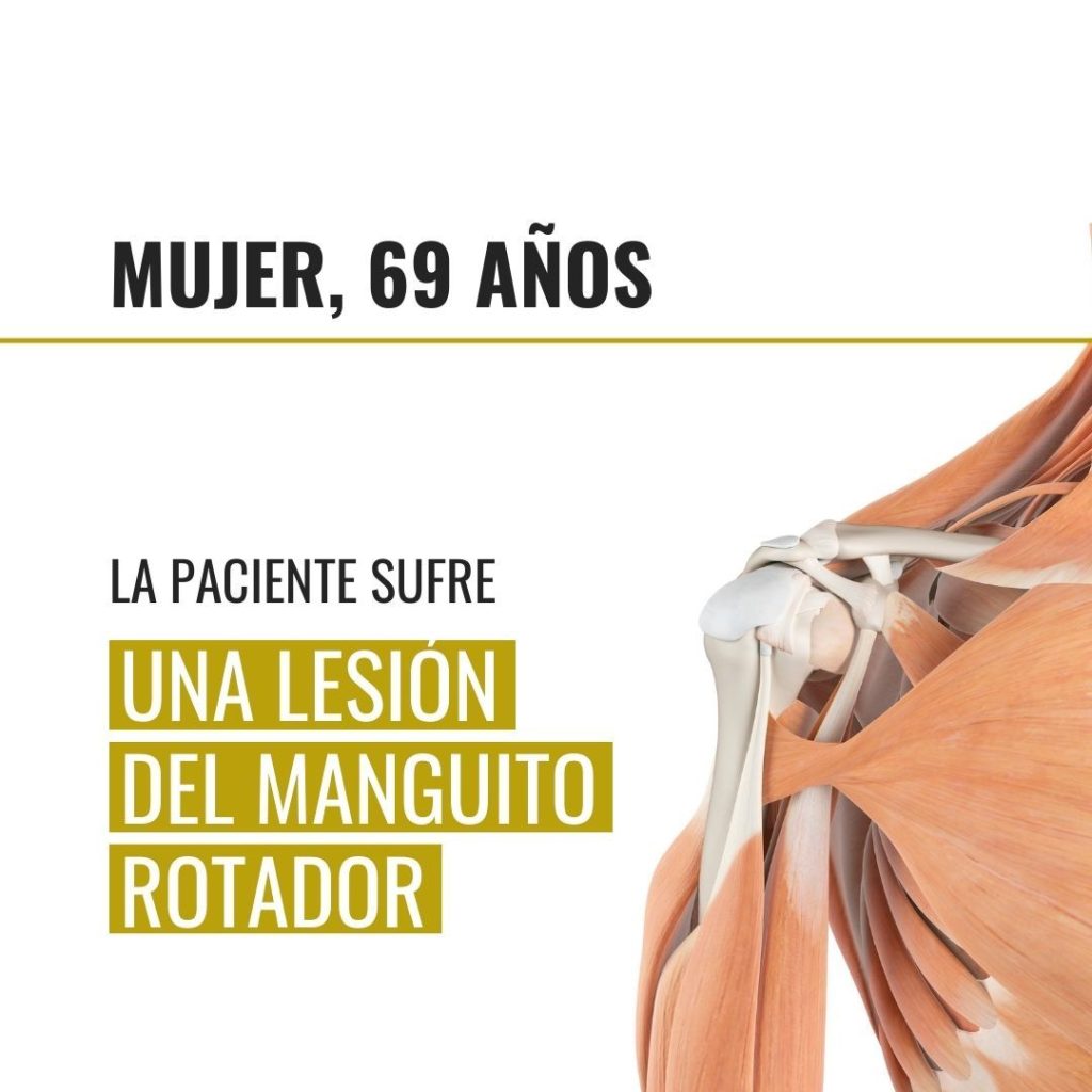 Rotura manguito rotador