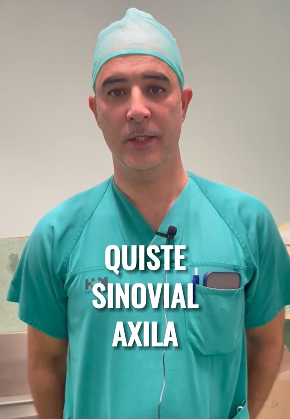 Quiste Sinovial Axila