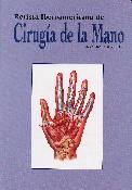 Cirugía de mano