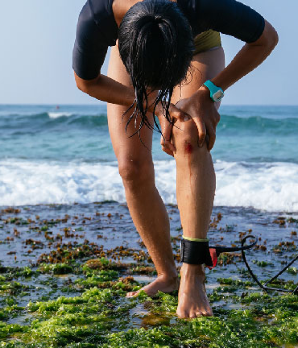 Tendinitis Rotuliana