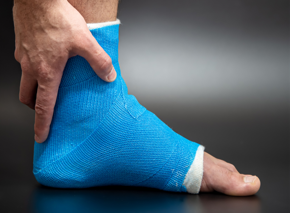 Tiempo de recuperación de la rotura del tendón de aquiles