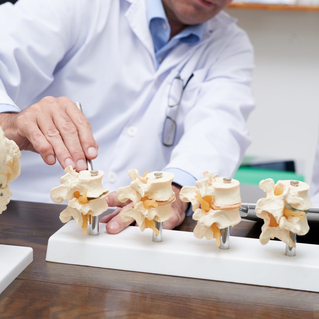 Explicación de la artrodesis vertebral